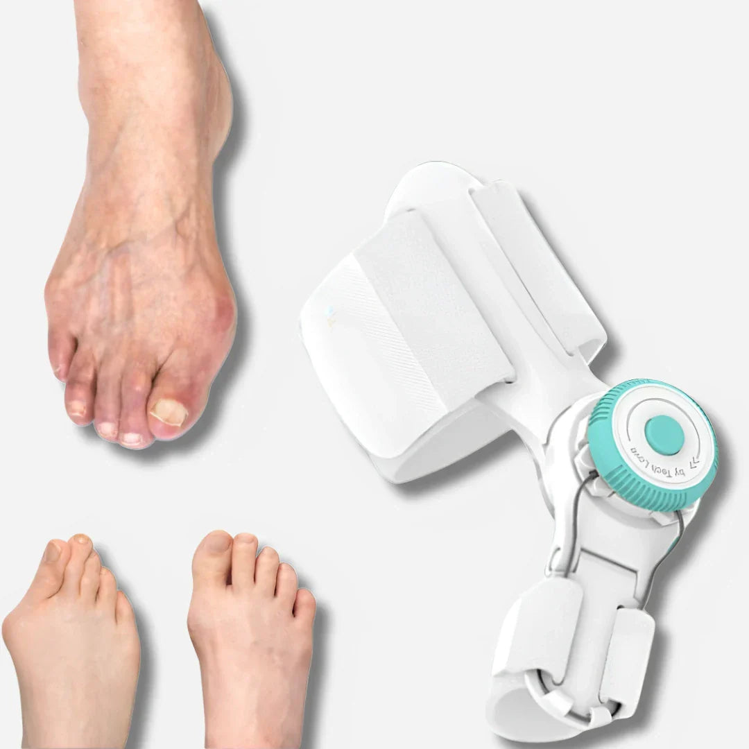 Solemarket | Justerbar tåkorrektor til hallux valgus og bunion korrektion